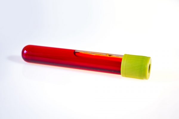 What Should You Not Do Before a Blood Test? featured image