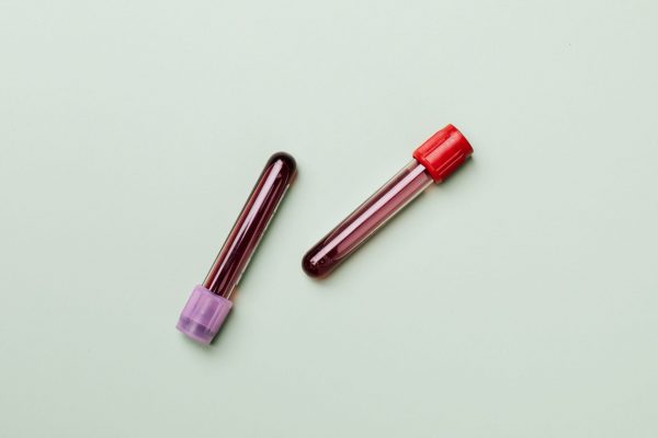 What are the Abbreviations on a Complete Blood Count? featured image