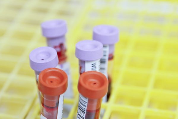 What Are Common Lab Tests? featured image