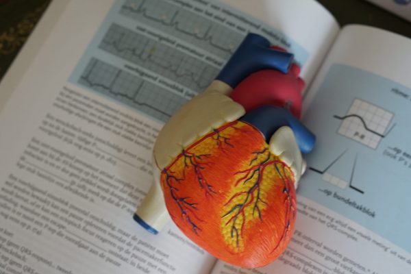 What is an Aortic Aneurysm Screening? featured image
