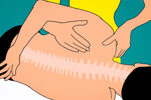What Cases Justify an Independent Medical Examination for Workers Compensation featured image