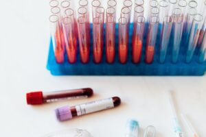 How we test for healthy blood vessels featured image