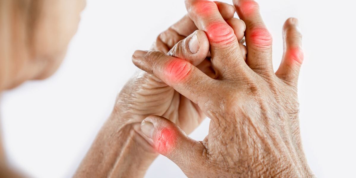 Arthritis in Summer: Causes, Triggers & Management banner