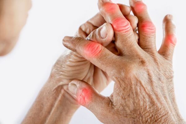 Arthritis in Summer: Causes, Triggers & Management featured image
